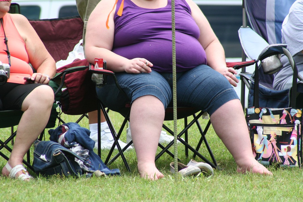 Obesity Epidemic