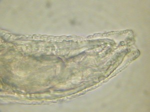 Roundworm Larva Head