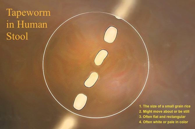 worm in human stool